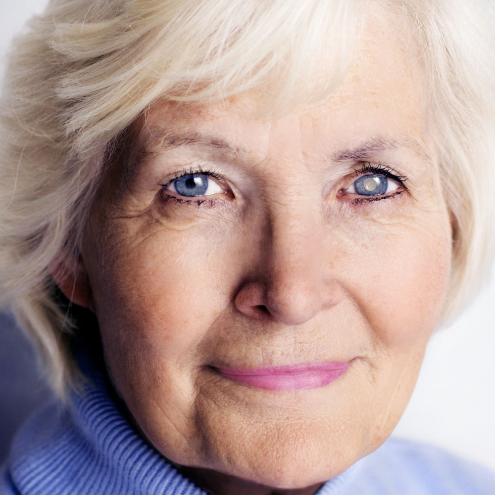 Cataract Surgery Co-Management in O'Fallon